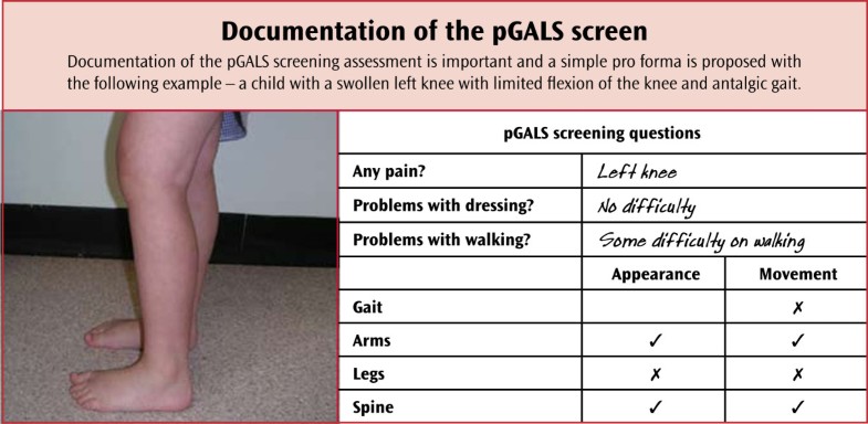 musculoskeletal physical exam documentation